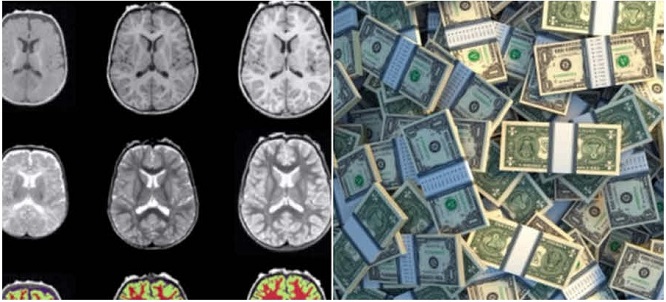 the-science-of-how-poverty-harms-the-brain